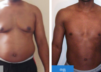 අයියෝ මම මහත වැඩියි – මගේ බඩ වැඩියි – ඔබත් මේ විදිහට හිතන කෙනෙක්නම් අනිවාර්යෙන්ම මේ ලිපිය කියවන්න