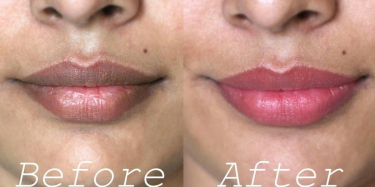 ඔබ තොල් කලු වෙලා නිසා අපහසුතාවයට පත්වුණ කෙනෙක්ද?