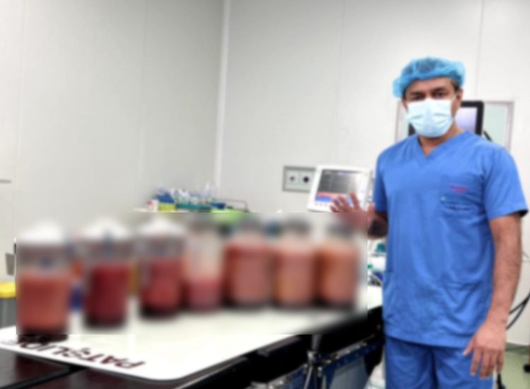 වාර්තාවක් වූ විස්මිත සැත්කමක්